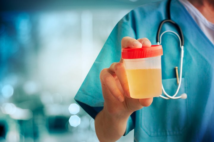 На Wildberries продают искусственную мочу «как у здорового человека»