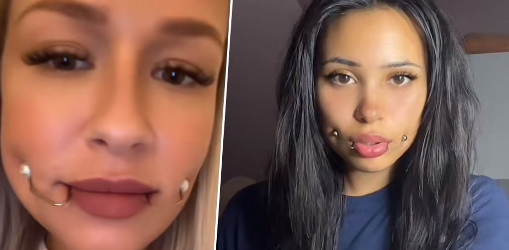 В TikTok учат делать милые ямочки на щеках. Правда, можно остаться с парализованным лицом