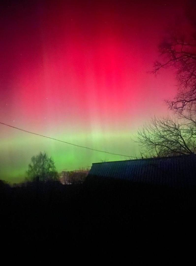 В Беларуси врачи спасли жизнь женщине с помощью искусственного интеллекта