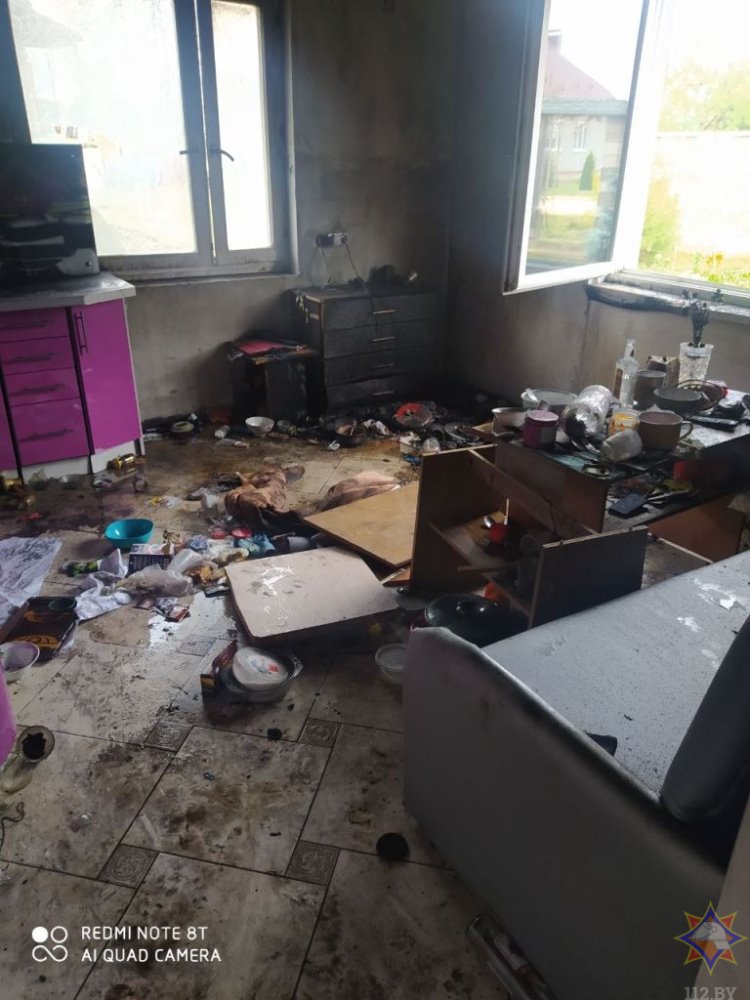 На пожаре в Брестском районе мужчина получил ожоги