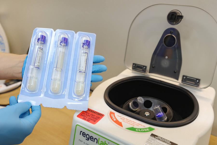 Как белорусы пересаживают волосы