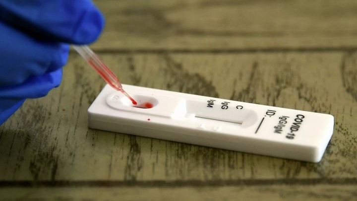 Минздрав разъяснил, как пользоваться экспресс-тестами на антитела