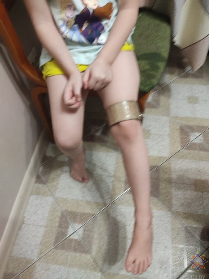 Как в Бресте спасали 6-летнюю девочку, которая надела на ногу картонный рулон и не смогла его снять