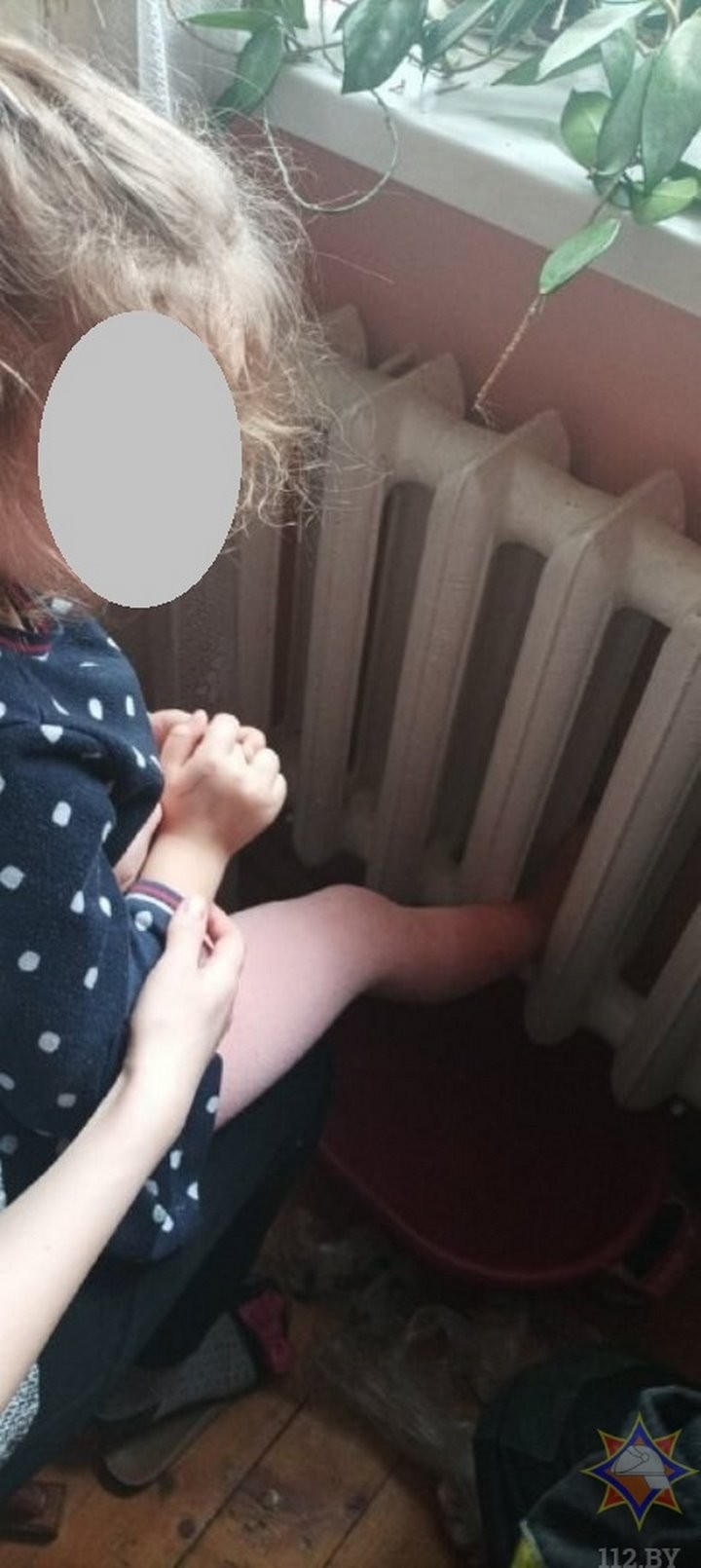 В Брестской области 5-летняя девочка застряла ногой в батарее