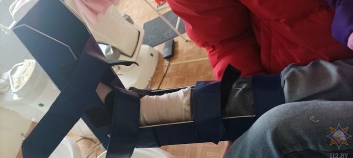 В Брестской области 5-летняя девочка застряла ногой в батарее