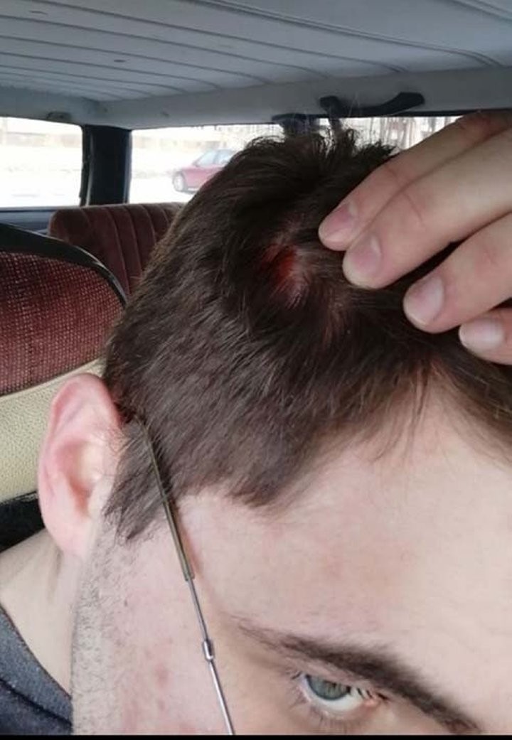 Заехал помыть машину, а получил вылетевшим пистолетом в голову. Кто виноват – клиент или мойка?