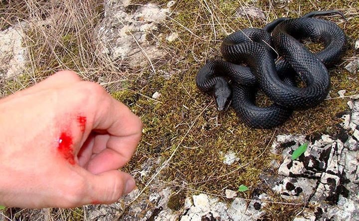 Нога опухла и почернела. Если гадюка укусила ребенка: вспоминаем последствия и учимся реагировать