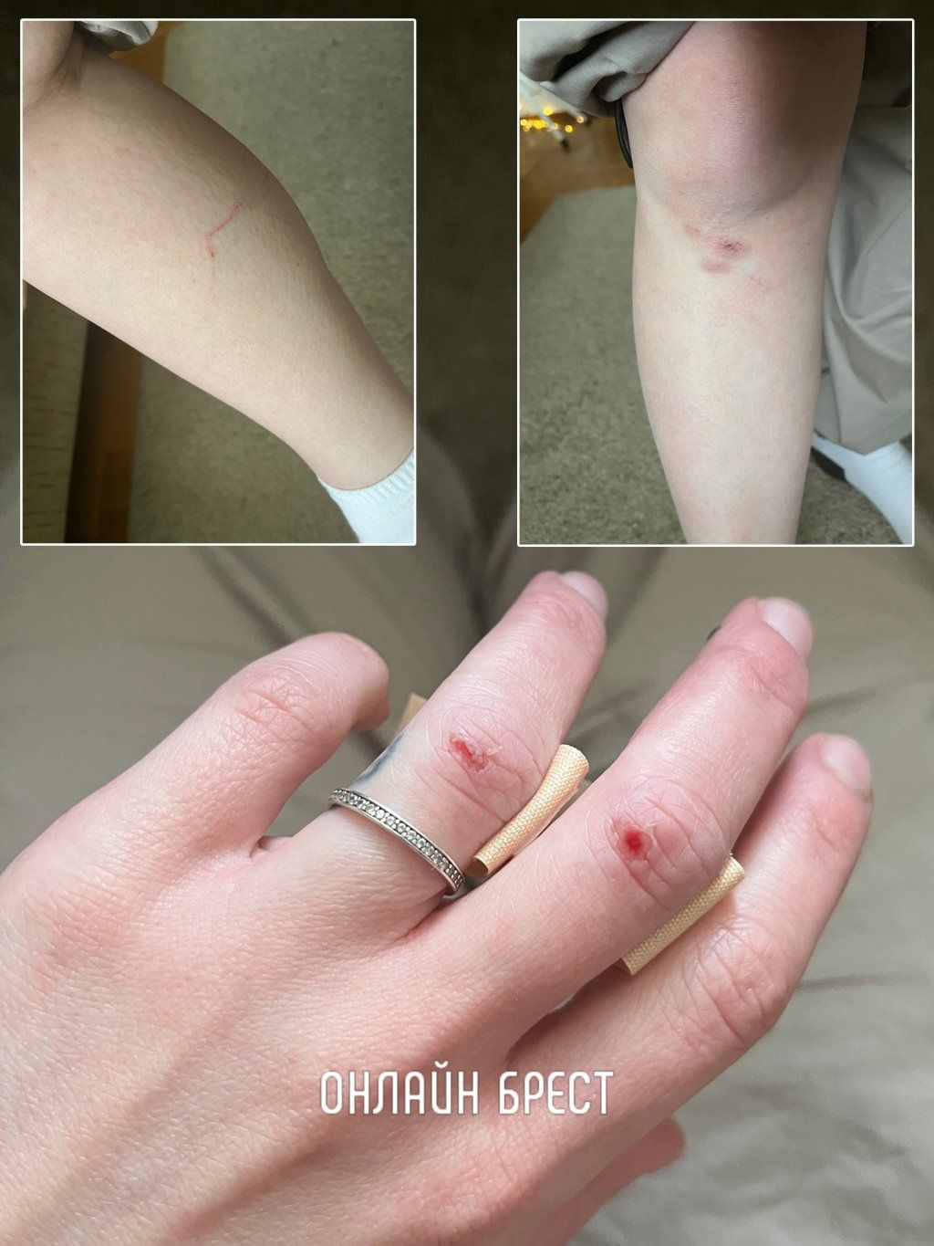 Читательница: Напала собака... Случай в Бресте