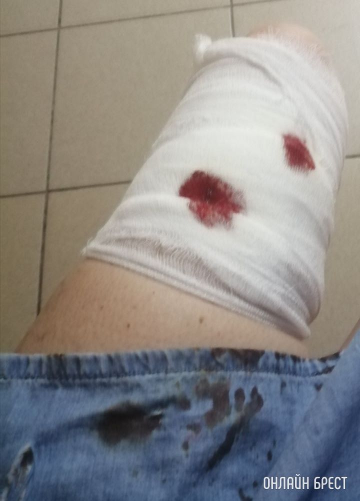 На меня напала собака