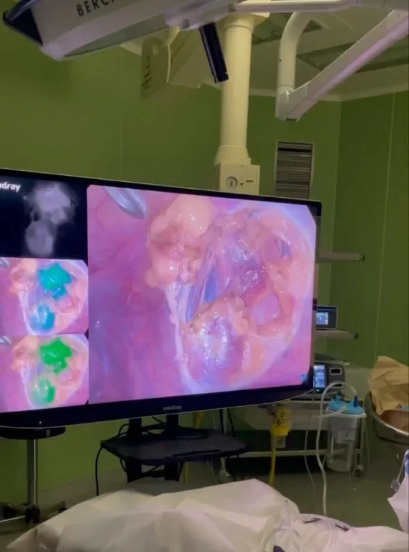 Уникальную операцию ребенку с опухолью кости провели в Беларуси