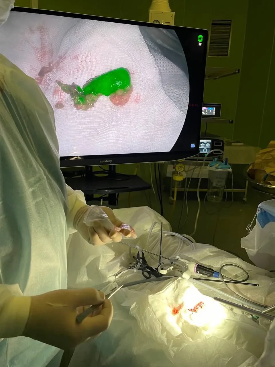 Уникальную операцию ребенку с опухолью кости провели в Беларуси