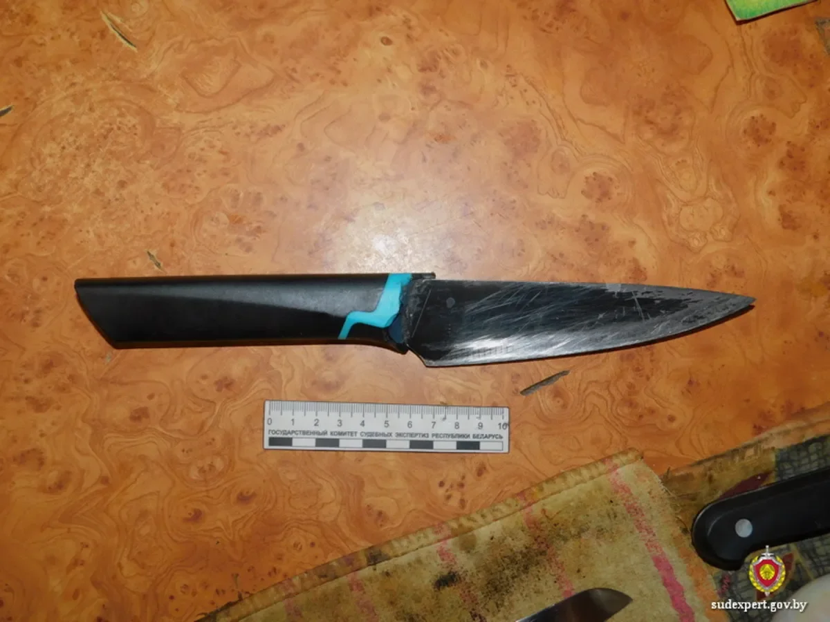 Белорус ранил себя на кухне и оказался в реанимации — как так вышло