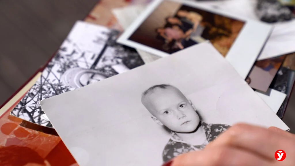 Как белоруска с алопецией прошла путь от парика до принятия себя