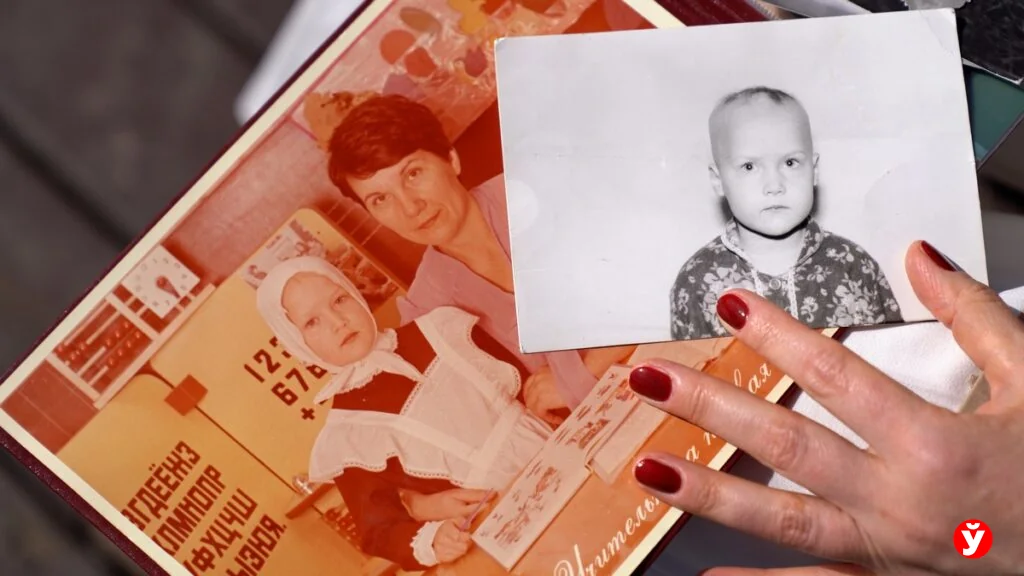 Как белоруска с алопецией прошла путь от парика до принятия себя