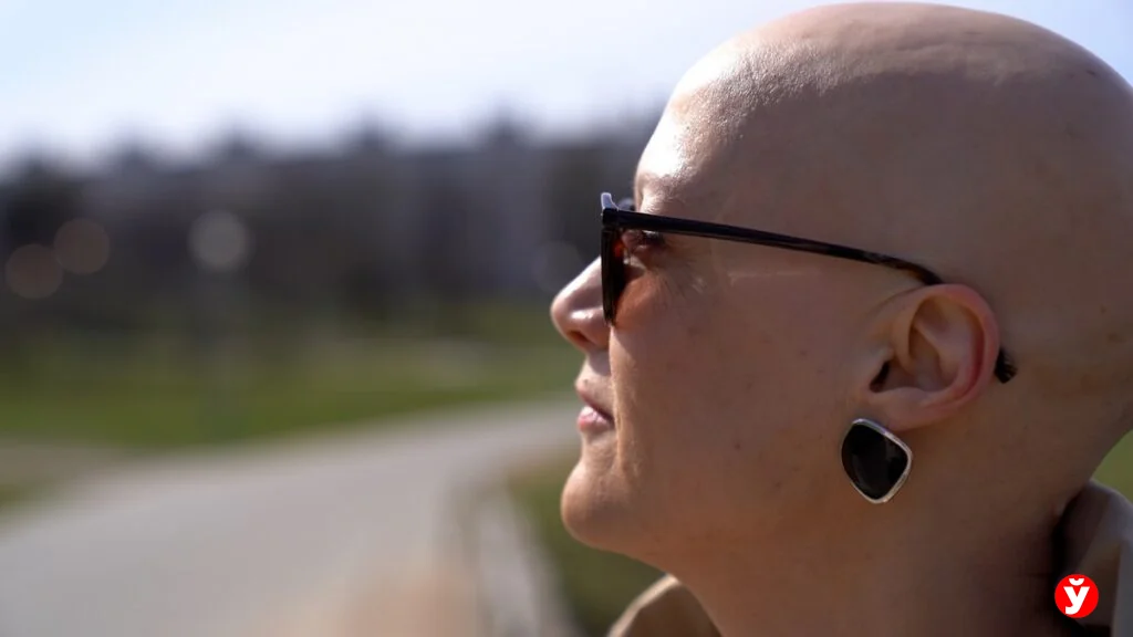 Как белоруска с алопецией прошла путь от парика до принятия себя