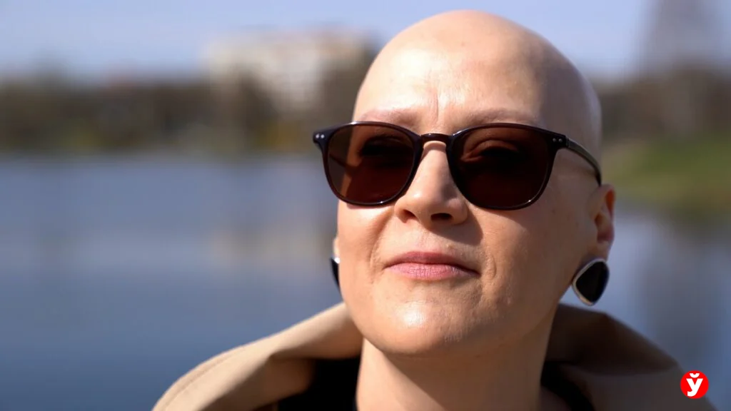 Как белоруска с алопецией прошла путь от парика до принятия себя