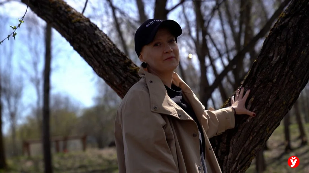 Как белоруска с алопецией прошла путь от парика до принятия себя