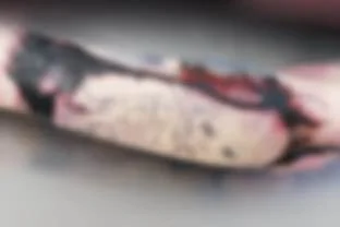 Тату в домашних условиях обернулось смертью