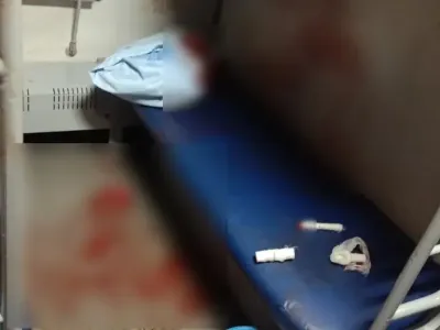 В поезде пьяный пассажир ударил попутчика ножом в шею — пострадавший в реанимации