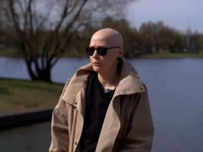 Как белоруска с алопецией прошла путь от парика до принятия себя