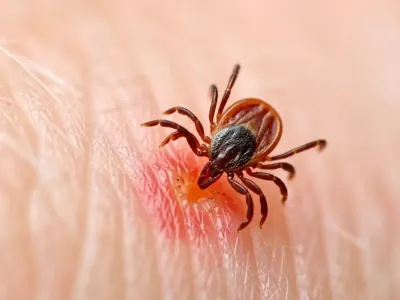 В Бресте клещи укусили уже 88 человек — и почти половина пострадавших дети